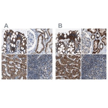 Anti-MDH2 antibody produced in rabbit Prestige Antibodies&#174; Powered by Atlas Antibodies, affinity isolated antibody, buffered aqueous glycerol solution