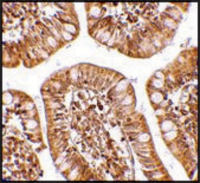 Anti-ZBP1 antibody produced in rabbit affinity isolated antibody, buffered aqueous solution