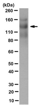 Anti-Thrombospondin-1 Antibody, clone 133 clone 133, from mouse