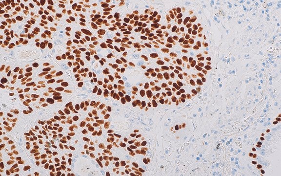 p63 (EP174) Rabbit Monoclonal Primary Antibody