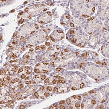 Anti-EPN3 antibody produced in rabbit Prestige Antibodies&#174; Powered by Atlas Antibodies, affinity isolated antibody, buffered aqueous glycerol solution