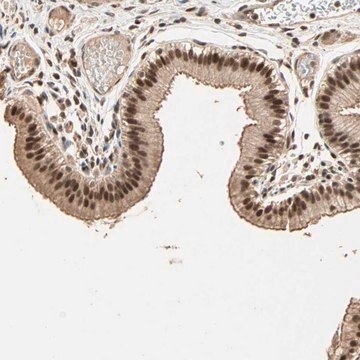 Anti-ZBTB33 antibody produced in rabbit Ab2, Prestige Antibodies&#174; Powered by Atlas Antibodies, affinity isolated antibody, buffered aqueous glycerol solution