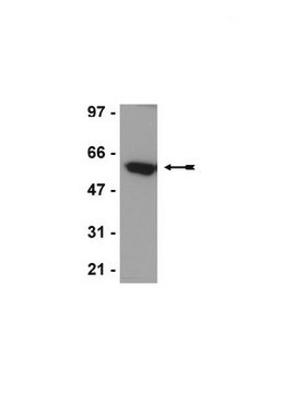 Anti-p54nrb/NonO Antibody, clone 78-1-C6 clone 78-1-C6, Upstate&#174;, from mouse