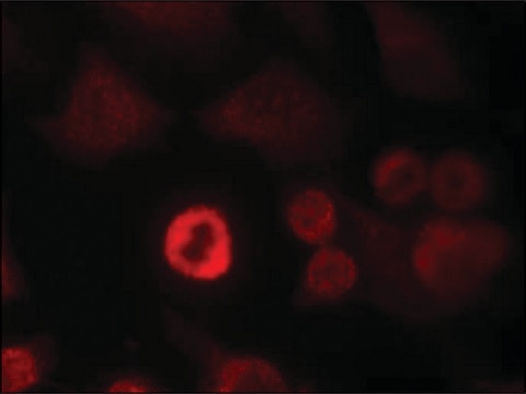 Anti-Snca (Ab-136) antibody produced in rabbit affinity isolated antibody