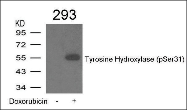 Anti-phospho-Tyrosine Hydroxylase (pSer31) antibody produced in rabbit affinity isolated antibody