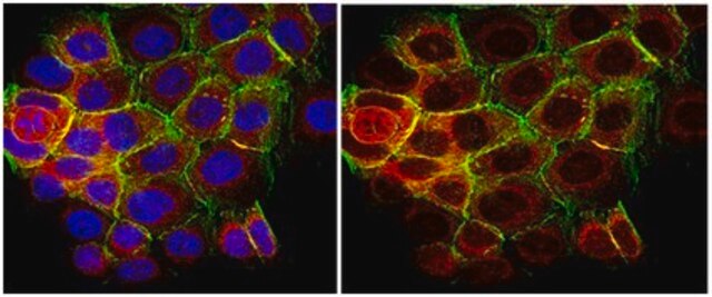 Anti-phospho-p70 S6 Kinase (Thr389) Antibody, clone 10G7.1 clone 10G7.1, from mouse