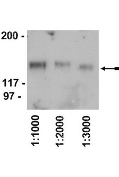 Rabbit Anti-Chicken IgY Antibody, HRP conjugate Upstate&#174;, from rabbit