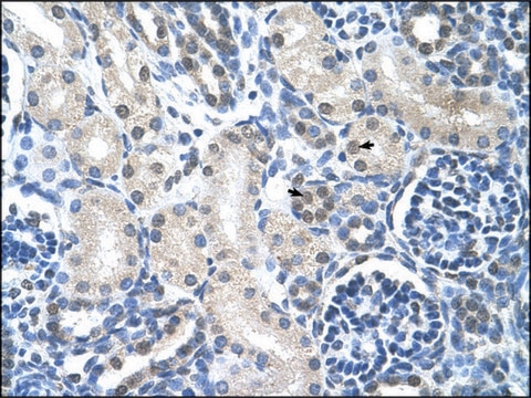 Anti-LOR IgG fraction of antiserum