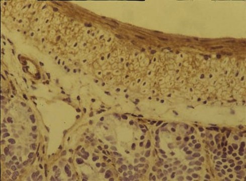 Anti-Integrin &#945;5&#946;1 Antibody, clone BMC5 ascites fluid, clone BMC5, Chemicon&#174;