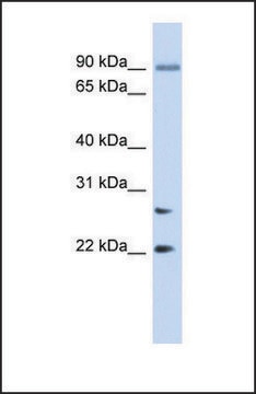 Anti-JOSD2, (N-terminal) antibody produced in rabbit affinity isolated antibody