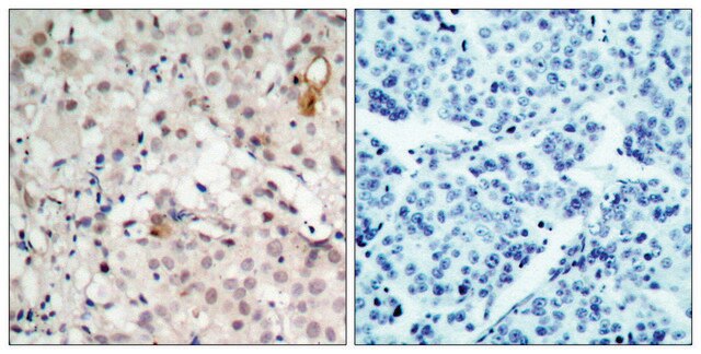 Anti-HER2 antibody produced in rabbit affinity isolated antibody