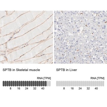 Anti-SPTB antibody produced in rabbit Ab2, Prestige Antibodies&#174; Powered by Atlas Antibodies, affinity isolated antibody, buffered aqueous glycerol solution