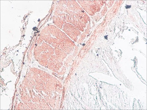 Anti-Myosin Light Chain Kinase antibody, Mouse monoclonal clone K36, purified from hybridoma cell culture