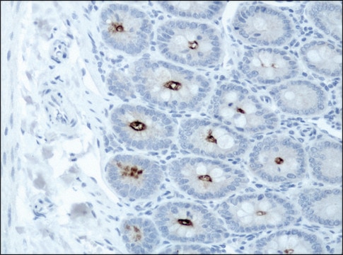 Anti-DSCR1 (C-terminal) antibody produced in rabbit ~1.5&#160;mg/mL, affinity isolated antibody, buffered aqueous solution