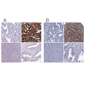 Anti-MYBPC3 antibody produced in rabbit Prestige Antibodies&#174; Powered by Atlas Antibodies, affinity isolated antibody, buffered aqueous glycerol solution