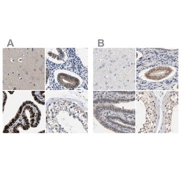 Anti-PGR antibody produced in rabbit Prestige Antibodies&#174; Powered by Atlas Antibodies, affinity isolated antibody, buffered aqueous glycerol solution