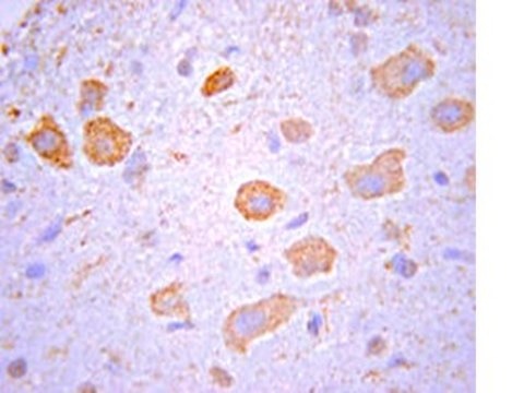 Anti-Nogo Receptor Antibody from rabbit