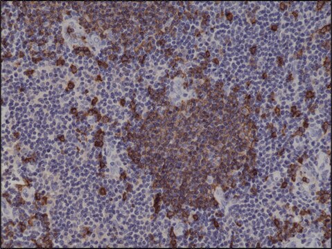 Anti-CD20 antibody, Rabbit monoclonal recombinant, expressed in HEK 293 cells, clone RM272, purified immunoglobulin