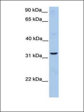 Anti-ATG5 antibody produced in rabbit affinity isolated antibody