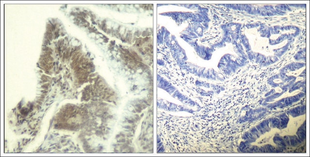 Anti-CDK6 (Ab-13) antibody produced in rabbit affinity isolated antibody