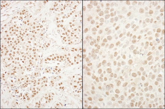 Rabbit anti-BRG1/SMARCA4 Antibody, Affinity Purified Powered by Bethyl Laboratories, Inc.