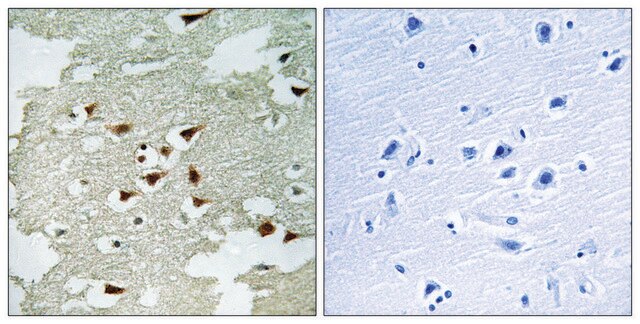 Anti-AKT antibody produced in rabbit affinity isolated antibody