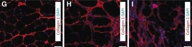 Anti-Rat Collagen Type I Antibody Chemicon&#174;, from rabbit