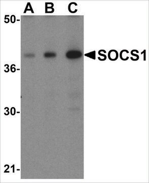 Anti-SOCS1 (ab1) antibody produced in rabbit affinity isolated antibody, buffered aqueous solution