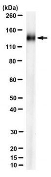 Anti-Podocalyxin Antibody, clone MECA99