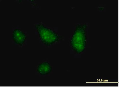 Anti-CISH antibody produced in mouse IgG fraction of antiserum, buffered aqueous solution