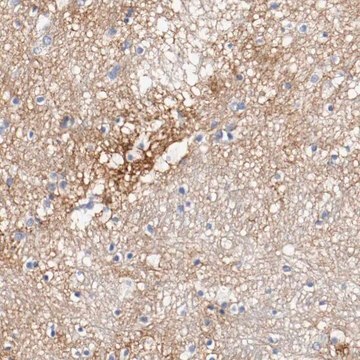 Anti-TNC antibody produced in rabbit Prestige Antibodies&#174; Powered by Atlas Antibodies, affinity isolated antibody, buffered aqueous glycerol solution