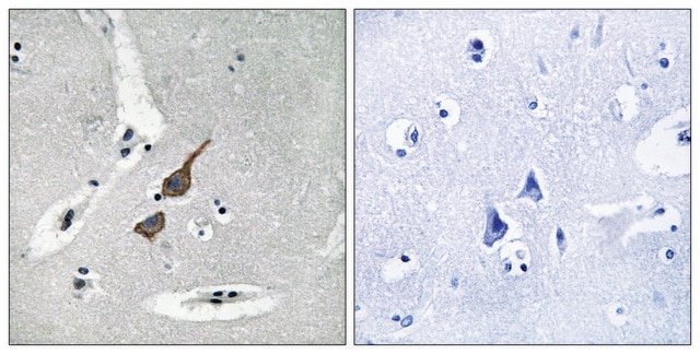 Anti-GRID1 antibody produced in rabbit affinity isolated antibody