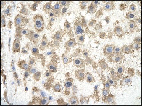 Anti-GPC3 IgG fraction of antiserum