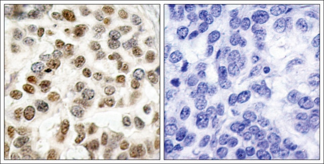 Anti-BRCA1 (Ab-1423) antibody produced in rabbit affinity isolated antibody