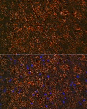 Anti-Myelin oligodendrocyte glycoprotein antibody produced in rabbit