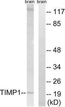 Anti-TIMP1 antibody produced in rabbit affinity isolated antibody