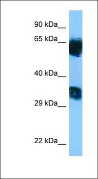 Anti-MGAT5B antibody produced in rabbit affinity isolated antibody