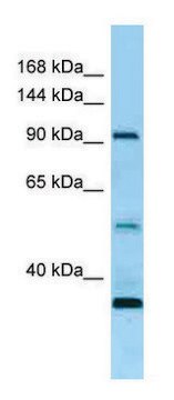 Anti-ROR1 (N-terminal) antibody produced in rabbit affinity isolated antibody