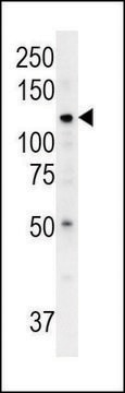 ANTI-ATP13A3 (N-TERM) antibody produced in rabbit IgG fraction of antiserum, buffered aqueous solution