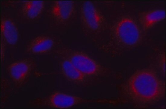 Anti-&#947;-Adaptin antibody, Mouse monoclonal clone 100/3, purified from hybridoma cell culture