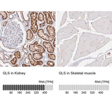 Anti-GLS antibody produced in rabbit Prestige Antibodies&#174; Powered by Atlas Antibodies, affinity isolated antibody, buffered aqueous glycerol solution