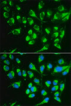 Anti-SLC22A5 antibody produced in rabbit affinity isolated antibody