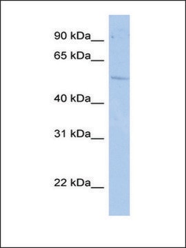 Anti-RORC (AB2) antibody produced in rabbit affinity isolated antibody