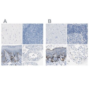 Anti-DCT antibody produced in rabbit Prestige Antibodies&#174; Powered by Atlas Antibodies, affinity isolated antibody, buffered aqueous glycerol solution