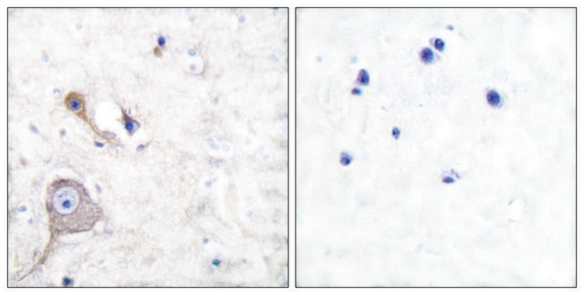 Anti-S100 A1, N-Terminal antibody produced in rabbit affinity isolated antibody