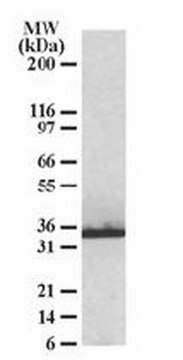 Anti-CHIP/STUB1 Antibody Chemicon&#174;, from goat