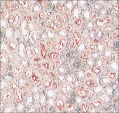 Anti-ACE2 (C-terminal) antibody produced in rabbit affinity isolated antibody, buffered aqueous solution