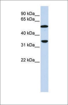 Anti-C4B antibody produced in rabbit affinity isolated antibody