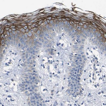 Anti-DSC1 antibody produced in rabbit Prestige Antibodies&#174; Powered by Atlas Antibodies, affinity isolated antibody, buffered aqueous glycerol solution