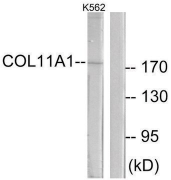 Anti-Collagen XI &#945;1 antibody produced in rabbit affinity isolated antibody